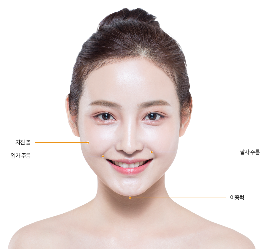 시술 부위
